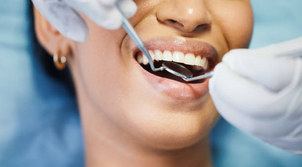 Best Emergency Tooth Extraction in Lambertville, NJ
